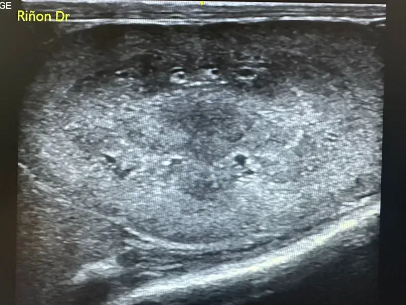 Ecografía de Riñones  - Clínica veterinaria de gatos | DeGatitos