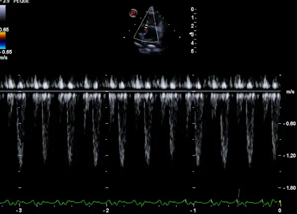 Cardiología Felina - Ecocardiografia Doppler  - Clínica veterinaria de gatos | DeGatitos