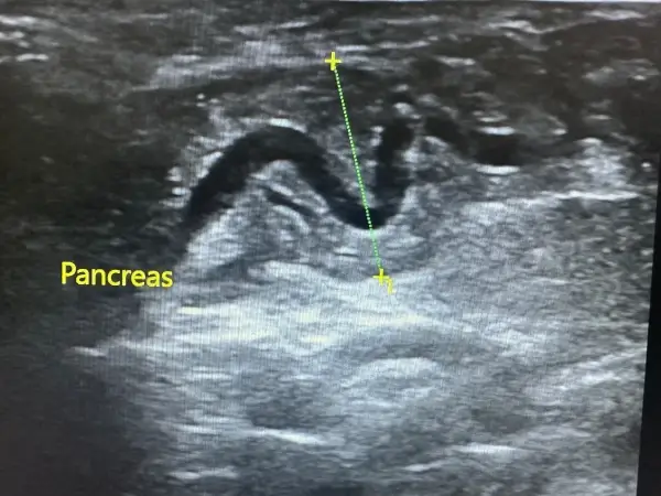 Gastroenterología Pancreas - Clínica veterinaria de gatos | DeGatitos