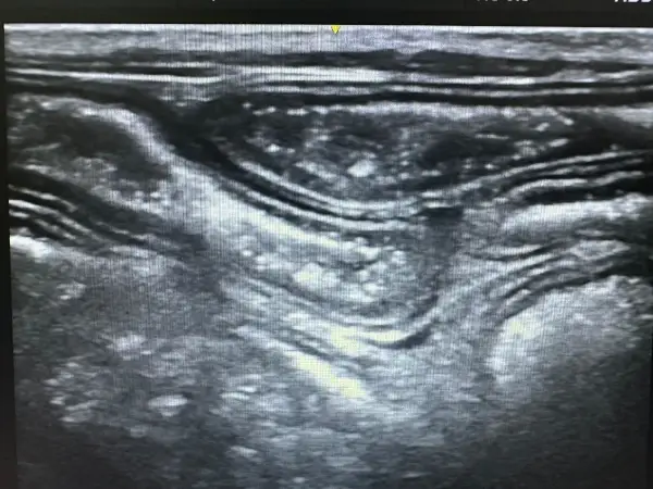 Gastroenterología Malabsorcion intestinal - Clínica veterinaria de gatos | DeGatitos