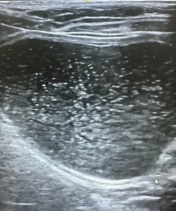 Sedimento Urinario en Vejiga - Clínica veterinaria de gatos DeGatitos