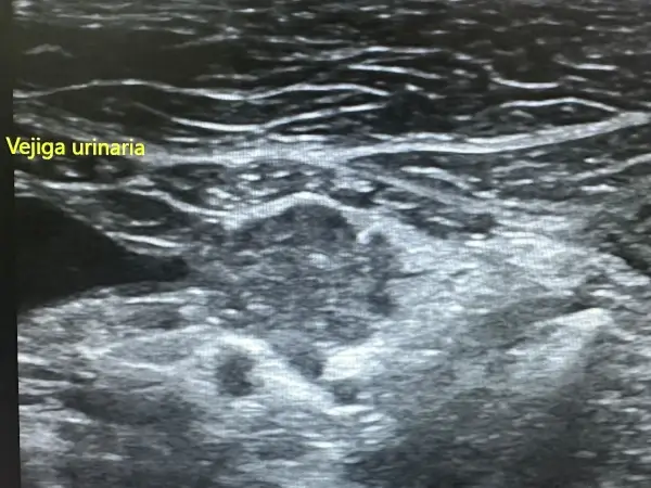 Oncología Neoplasia - Clínica veterinaria de gatos | DeGatitos