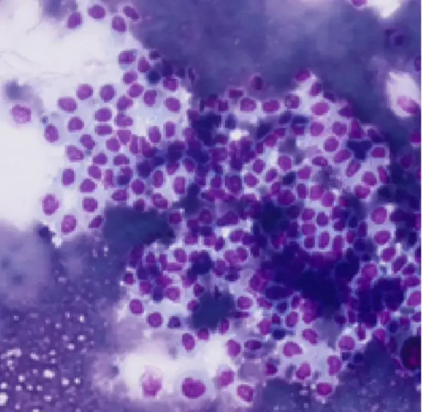 Oncología Carcinoma Urotelial - Clínica veterinaria de gatos | DeGatitos